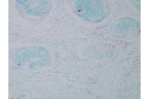 Immunohistochemistry analysis using Mouse Anti-Nitrotyrosine Monoclonal Antibody, Clone 39B6 . (Nitrotyrosine antibody  (HRP))