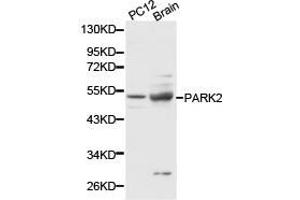 Western Blotting (WB) image for anti-Parkinson Protein 2, E3 Ubiquitin Protein Ligase (Parkin) (PARK2) antibody (ABIN1874032) (Parkin antibody)