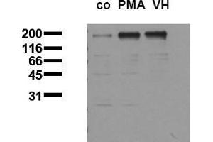 Western Blotting (WB) image for anti-Epidermal Growth Factor Receptor (EGFR) (pThr678) antibody (ABIN126757) (EGFR antibody  (pThr678))