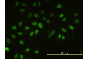 Immunofluorescence of monoclonal antibody to UBE2H on HeLa cell. (UBE2H antibody  (AA 1-183))