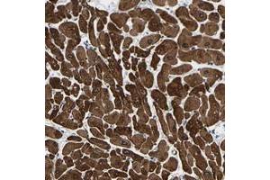 Immunohistochemical staining of human heart muscle with METTL16 polyclonal antibody  shows strong cytoplasmic positivity in myocytes at 1:200-1:500 dilution. (METTL16 antibody)