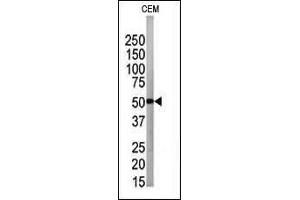 The anti-G4B Pab 1809a is used in Western blot to detect G4B in CEM tissue lysate (ATG4B antibody  (N-Term))