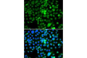 Immunofluorescence analysis of A549 cell using NAP1L3 antibody.