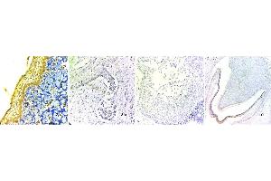 Staining of stages of odontogenesis: (1a) shows H and E stained dental lamina at x400, (1b) shows H and E stained bud stage at x400, (1c) shows H and E stained cap stage at x400, (1d) shows H and E stained bell stage at x100.