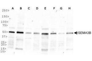 Western Blotting (WB) image for anti-Sema Domain, Immunoglobulin Domain (Ig), Short Basic Domain, Secreted, (Semaphorin) 3B (SEMA3B) (AA 100-200) antibody (ABIN1951824) (SEMA3B antibody  (AA 100-200))