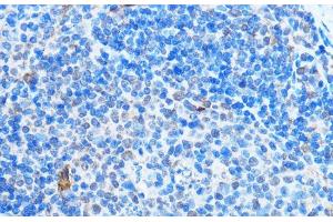 Immunohistochemistry of paraffin-embedded Mouse spleen using ADAR Polyclonal Antibody at dilution of 1:100 (40x lens).