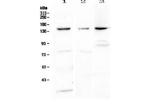 Western blot analysis of VEGF Receptor 1  using anti-VEGF Receptor 1  antibody . (FLT1 antibody)