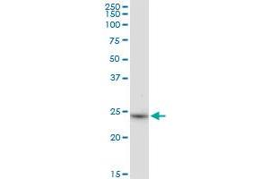 BDH2 MaxPab polyclonal antibody. (BDH2 antibody  (AA 1-245))