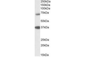 Antibody (1µg/ml) staining of Peripheral Blood Lymphocytes lysate (35µg protein in RIPA buffer). (TRIM29 antibody  (Internal Region))