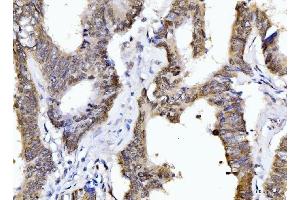 IHC analysis of Cyclophilin E/PPIE using anti-Cyclophilin E/PPIE antibody (ABIN7599242). (PPIE antibody  (AA 1-301))