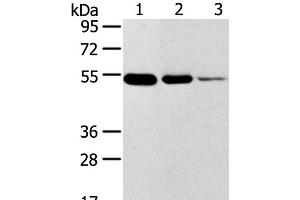 Western Blot analysis of Human thyroid and esophagus cancer, Human normal rectum tissue using TMPRSS11F Polyclonal Antibody at dilution of 1:500 (TMPRSS11F antibody)
