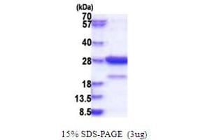 SDS-PAGE (SDS) image for Syntaxin Binding Protein 6 (Amisyn) (STXBP6) (AA 1-210) protein (His tag) (ABIN5853834) (STXBP6 Protein (AA 1-210) (His tag))