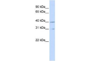 WB Suggested Anti-CCNH Antibody Titration:  0. (Cyclin H antibody  (Middle Region))