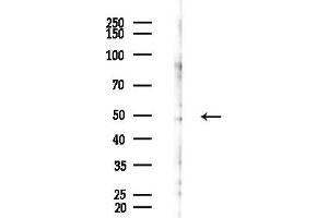 anti-PlcH Gene Product (PLCH) (Internal Region) antibody