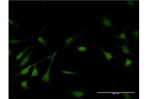 Immunofluorescence of monoclonal antibody to GSTP1 on HeLa cell. (GSTP1 antibody  (AA 1-210))