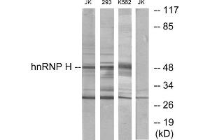 Western blot analysis of extracts from Jurkat cells, 293 cells and K562 cells, using hnRNP H antibody. (HNRNPH1 antibody  (Internal Region))