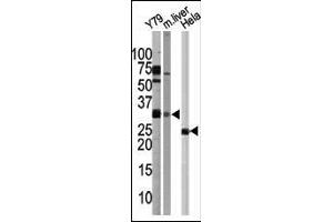 Western blot analysis of G5L Pab in Y79 cell line, mouse liver tissue, and Hela cell line lysates 1812b. (ATG5 antibody  (C-Term))