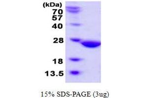 SDS-PAGE (SDS) image for Abhydrolase Domain Containing 14B (ABHD14B) (AA 1-210) protein (His tag) (ABIN667663) (ABHD14B Protein (AA 1-210) (His tag))