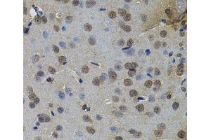 Immunohistochemistry of paraffin-embedded Rat brain using IL33 Polyclonal Antibody (IL-33 antibody)