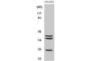 Western Blotting (WB) image for anti-Cathepsin B (CTSB) (Internal Region) antibody (ABIN3183690)
