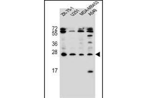 EDN1 Antibody (C-term) (ABIN655912 and ABIN2845311) western blot analysis in ZR-75-1,,MDA-M,A549 cell line lysates (35 μg/lane). (Endothelin 1 antibody  (C-Term))