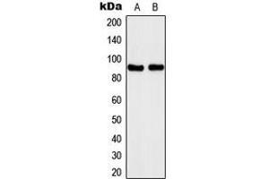Western blot analysis of Kanadaptin expression in A431 (A), Jurkat (B) whole cell lysates. (NADAP antibody  (Center))