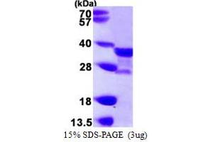 N-Acetyltransferase 1 (Arylamine N-Acetyltransferase) (NAT1) (AA 1-290) protein (His tag)