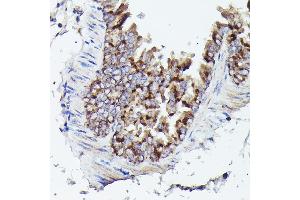 Immunohistochemistry of paraffin-embedded mouse lung using VD Rabbit pAb (ABIN6130775, ABIN6150077, ABIN6150078 and ABIN6214830) at dilution of 1:25 (40x lens). (VDAC3 antibody  (AA 1-283))