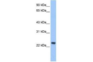 Western Blot showing TRIM48 antibody used at a concentration of 1-2 ug/ml to detect its target protein. (TRIM48 antibody  (C-Term))