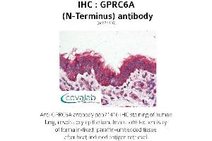 Image no. 2 for anti-G Protein-Coupled Receptor, Family C, Group 6, Member A (GPRC6A) (Extracellular Domain), (N-Term) antibody (ABIN1735226) (GPRC6A antibody  (Extracellular Domain, N-Term))