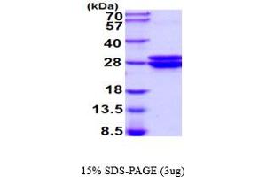 SDS-PAGE (SDS) image for Glyoxalase I (GLO1) (AA 1-184) (Active) protein (His tag) (ABIN6387797)