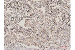 IHC analysis of LPP using anti-LPP antibody (ABIN7599606). (LPP antibody  (AA 10-572))