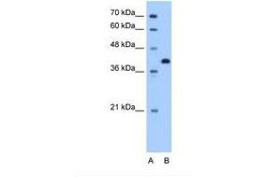 Image no. 1 for anti-Torsin Family 2, Member A (TOR2A) (AA 51-100) antibody (ABIN341411) (TOR2A antibody  (AA 51-100))