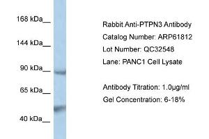 Western Blotting (WB) image for anti-Protein tyrosine Phosphatase, Non-Receptor Type 3 (PTPN3) (N-Term) antibody (ABIN2774324)