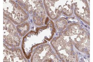 ABIN6272960 at 1/100 staining Mouse kidney tissue by IHC-P. (GLUD1 antibody  (Internal Region))