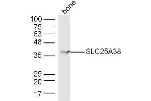 Mouse bone lysates probed with SLC25A38 Polyclonal Antibody, Unconjugated  at 1:300 dilution and 4˚C overnight incubation. (SLC25A38 antibody  (AA 101-200))
