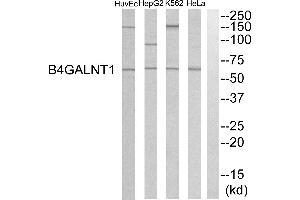 Western blot analysis of extracts from HeLa cells, K562 cells, HepG2 cells and HuvEC cells, using B4GALNT1 antibody. (B4GALNT1 antibody)