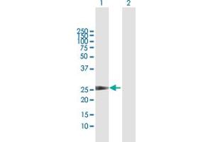 Western Blot analysis of CCBE1 expression in transfected 293T cell line by CCBE1 MaxPab polyclonal antibody.