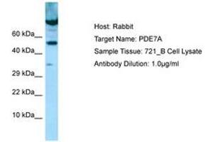 Image no. 1 for anti-phosphodiesterase 7A (PDE7A) (AA 338-387) antibody (ABIN6749987) (PDE7A antibody  (AA 338-387))