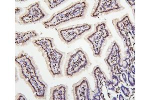 IHC analysis of H1F0 using anti-H1F0 antibody (ABIN7600521). (Histone H1 antibody  (AA 20-159))