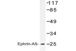 Western blot analysis of Ephrin-A5 antibody in extracts from HeLa cells. (Ephrin A5 antibody)