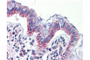 IMPDH1 antibody was used for immunohistochemistry at a concentration of 4-8 ug/ml. (IMPDH1 antibody)