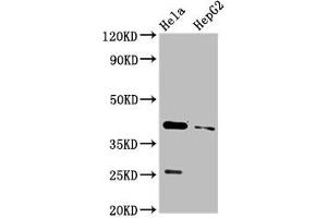 Western Blot Positive WB detected in: Hela whole cell lysate, HepG2 whole cell lysate All lanes: CD72 antibody at 3.