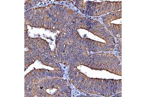 IHC analysis of Scavenging Receptor SRB2/SCARB2 using anti-Scavenging Receptor SRB2/SCARB2 antibody (ABIN7601833). (SCARB2 antibody  (AA 48-357))