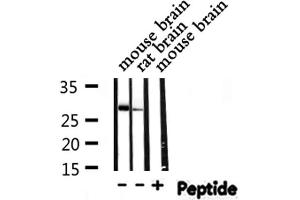 Western blot analysis of THOC4 expression in various lysates (THO Complex 4 antibody  (Internal Region))