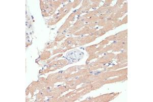 Immunohistochemistry of paraffin-embedded mouse kidney using WNT5B antibody (ABIN6130798, ABIN6150250, ABIN6150251 and ABIN6224330) at dilution of 1:100 (40x lens).