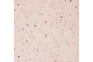 Immunohistochemistry (IHC) image for anti-Apurinic/Apyrimidinic Endonuclease 1 (APEX1) (AA 2-318) antibody (ABIN3043785)