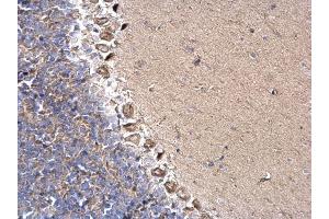 Immunohistochemistry (IHC) image for anti-Dynein, Cytoplasmic 1, Intermediate Chain 2 (DYNC1I2) antibody (ABIN2856863)
