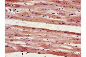 Immunohistochemistry of paraffin-embedded human heart tissue using ABIN7153133 at dilution of 1:100 (FHL2 antibody  (AA 112-233))