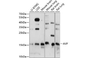 Western blot analysis of extracts of various cell lines, using AVP antibody (ABIN7265664) at 1:1000 dilution. (Vasopressin antibody  (AA 20-164))
